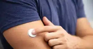 man with a glucose monitor pad fix to his arm to monitor blood glucose to help insulin and weight loss