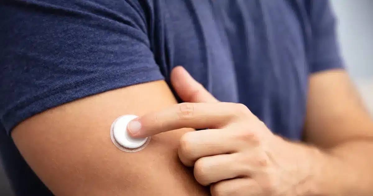man with a glucose monitor pad fix to his arm to monitor blood glucose to help insulin and weight loss
