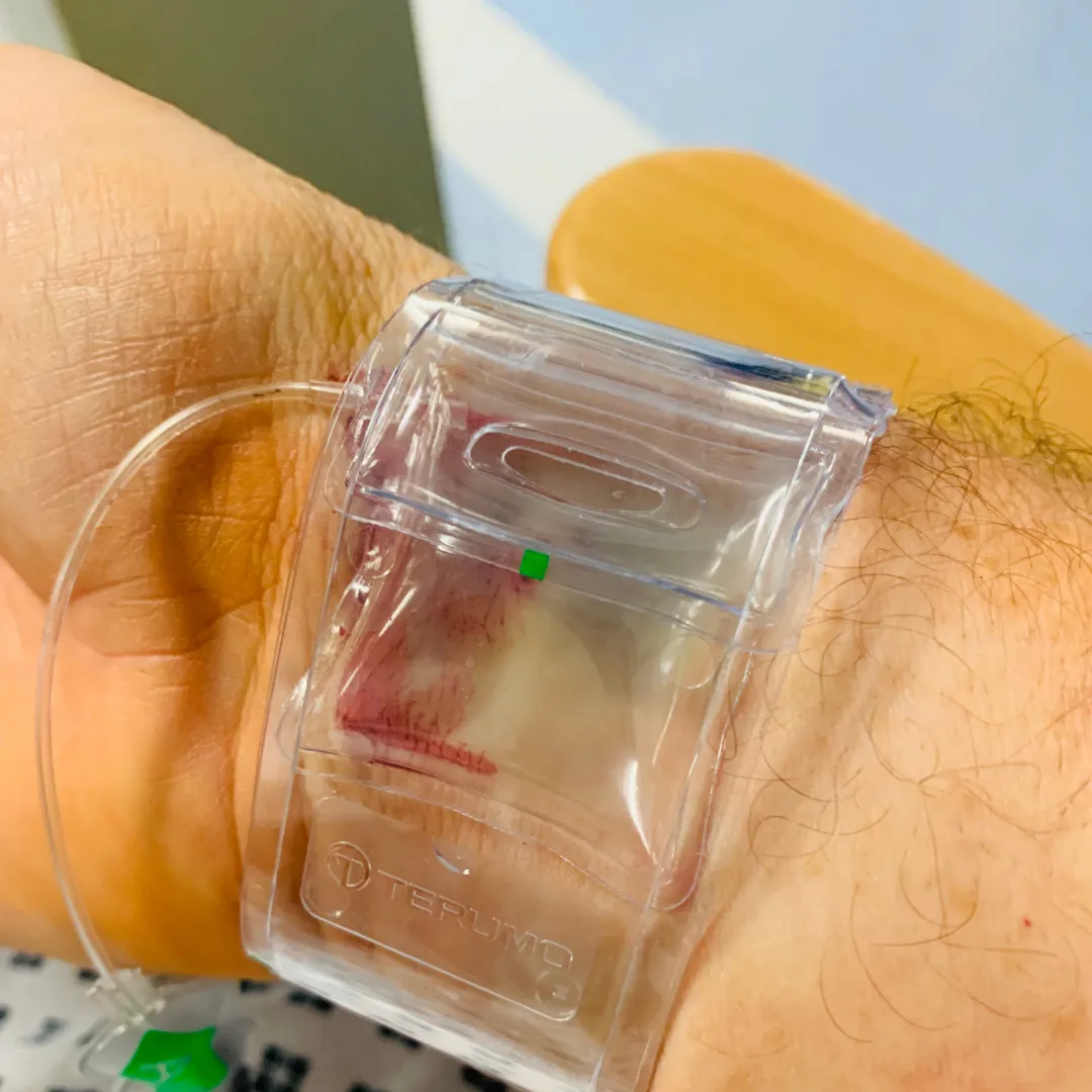 metabolic health guide - angiogram recovery after cardiac event